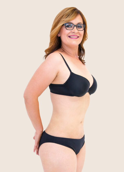 Liposukce břicha a boků po zákroku